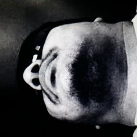 Anthony Melchor
